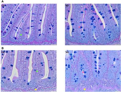 Intestinal Transcriptome Analysis Reveals Soy Derivative-Linked Changes in Atlantic Salmon